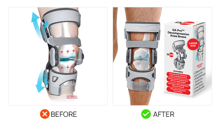 Amazon Main Image CTR Upgrade v3 14 Knee brace product using the Amazon main image hack
